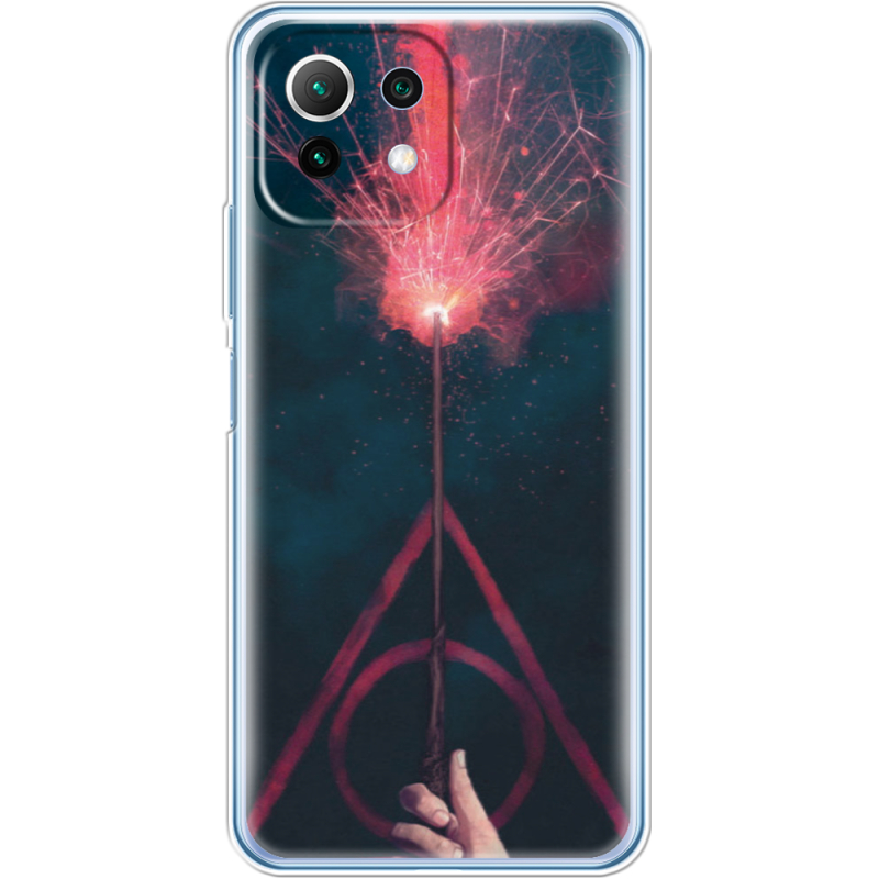Чехол BoxFace  Xiaomi 11 Lite 5G NE 