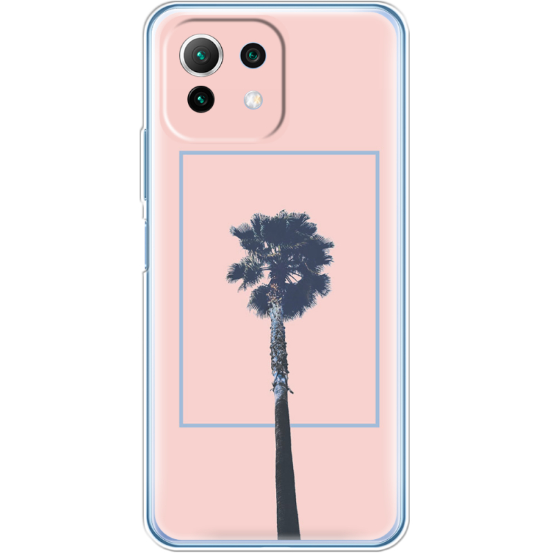 Чехол BoxFace  Xiaomi 11 Lite 5G NE 