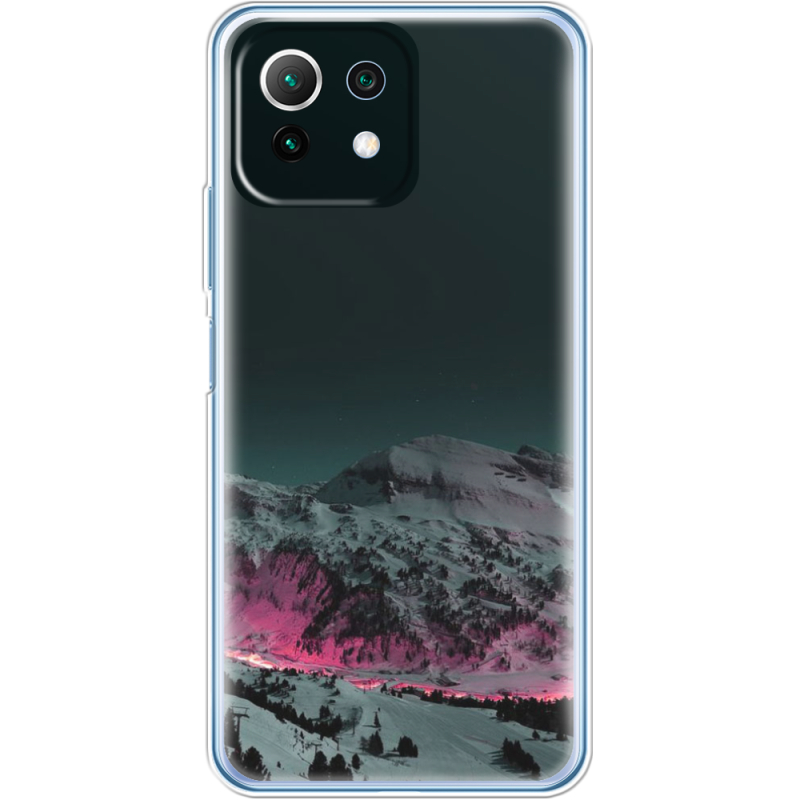 Чехол BoxFace  Xiaomi 11 Lite 5G NE 