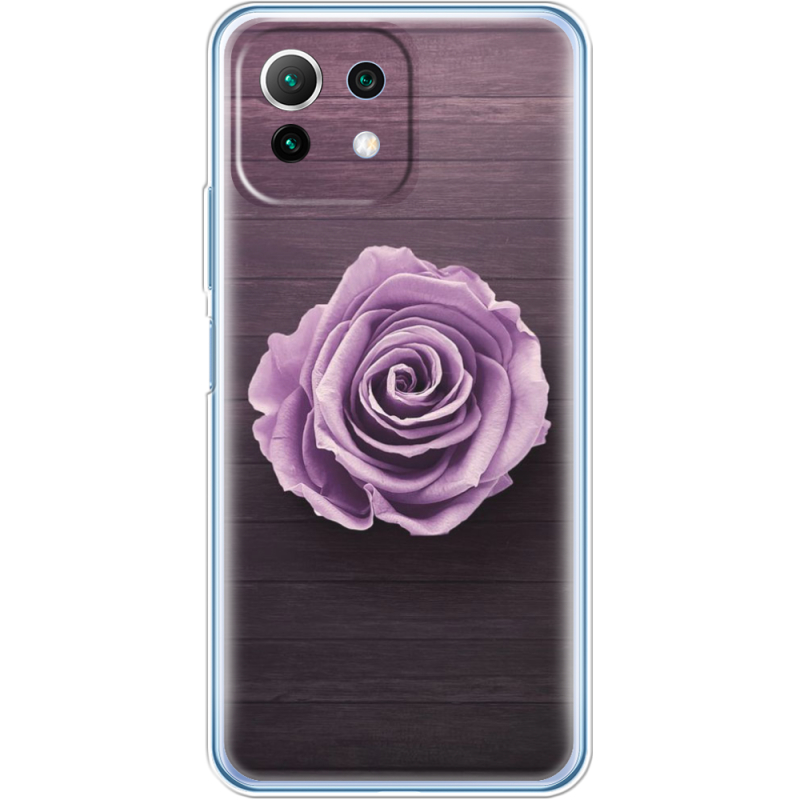 Чехол BoxFace  Xiaomi 11 Lite 5G NE 