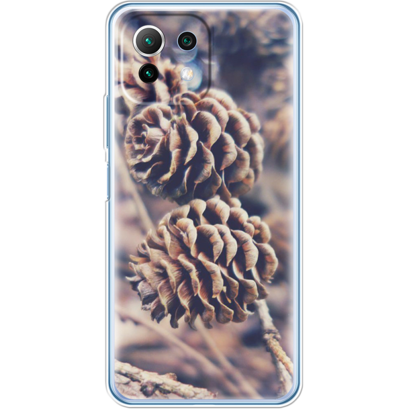 Чехол BoxFace  Xiaomi 11 Lite 5G NE 