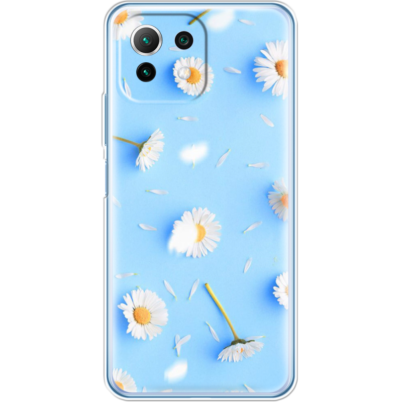 Чехол BoxFace  Xiaomi 11 Lite 5G NE 