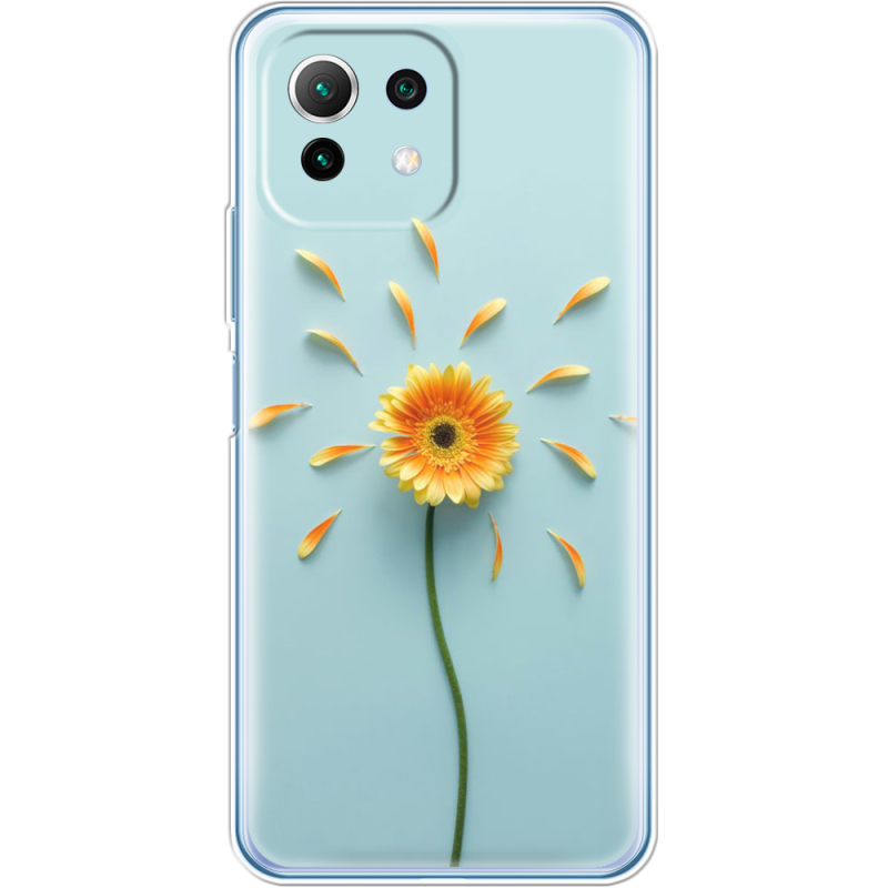 Чехол BoxFace  Xiaomi 11 Lite 5G NE 