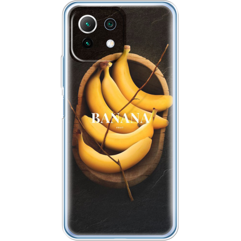 Чехол BoxFace  Xiaomi 11 Lite 5G NE 