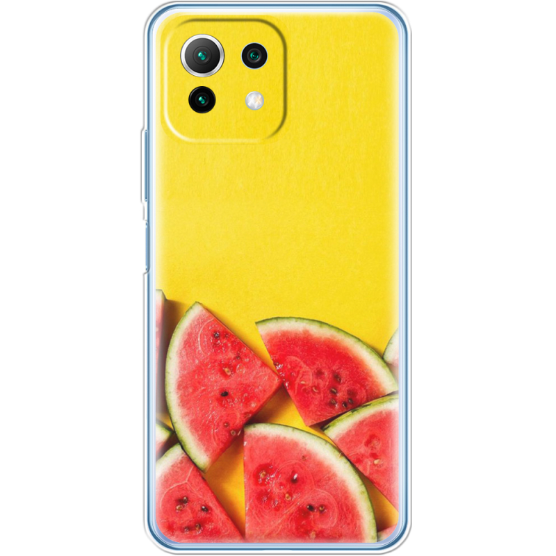 Чехол BoxFace  Xiaomi 11 Lite 5G NE 