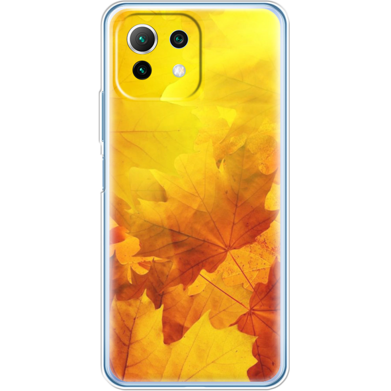 Чехол BoxFace  Xiaomi 11 Lite 5G NE 