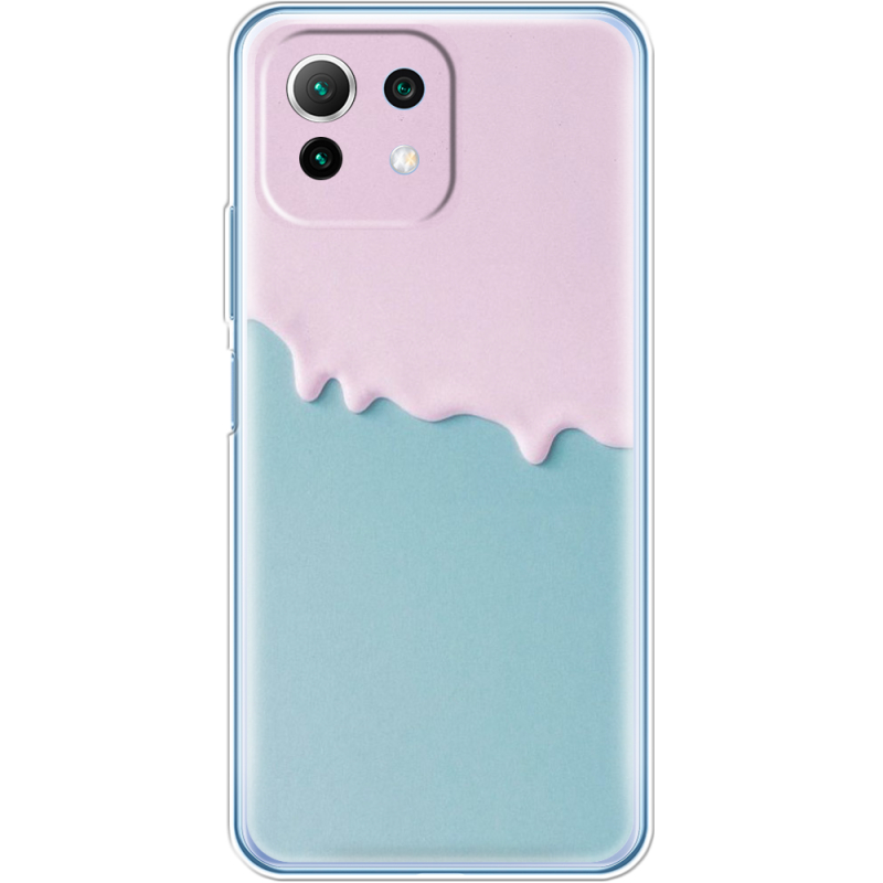Чехол BoxFace  Xiaomi 11 Lite 5G NE 