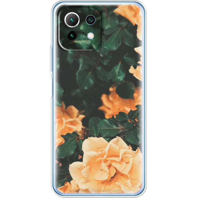 Чехол BoxFace  Xiaomi 11 Lite 5G NE 