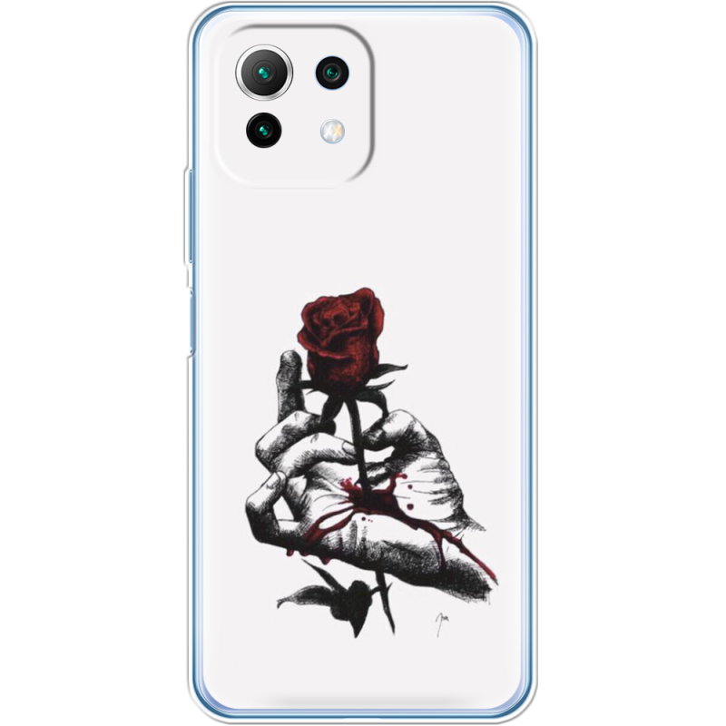 Чехол BoxFace  Xiaomi 11 Lite 5G NE 