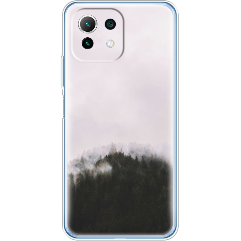 Чехол BoxFace  Xiaomi 11 Lite 5G NE 