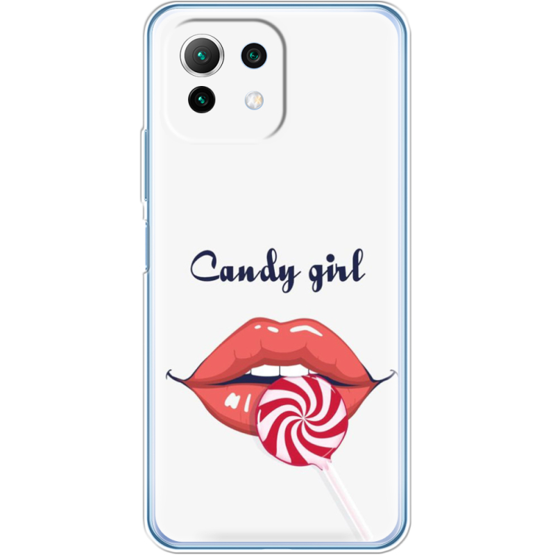 Чехол BoxFace  Xiaomi 11 Lite 5G NE 