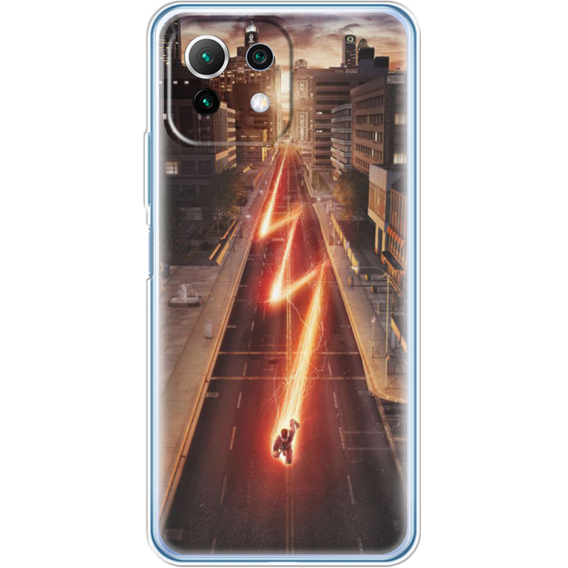 Чехол BoxFace  Xiaomi 11 Lite 5G NE 