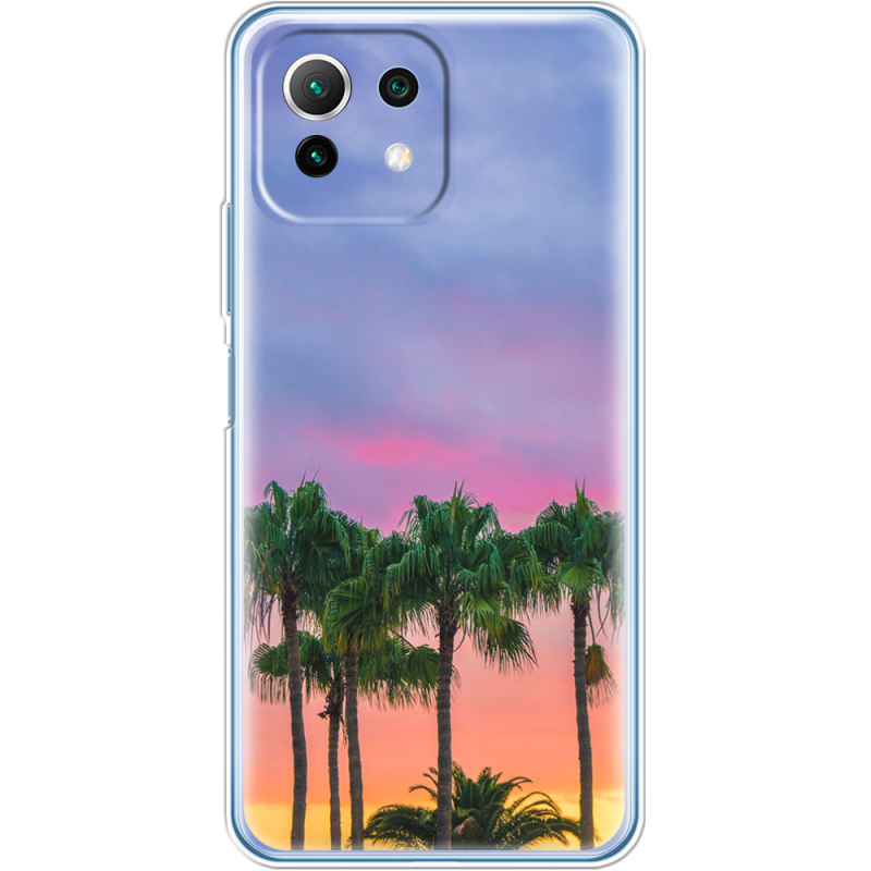 Чехол BoxFace  Xiaomi 11 Lite 5G NE 