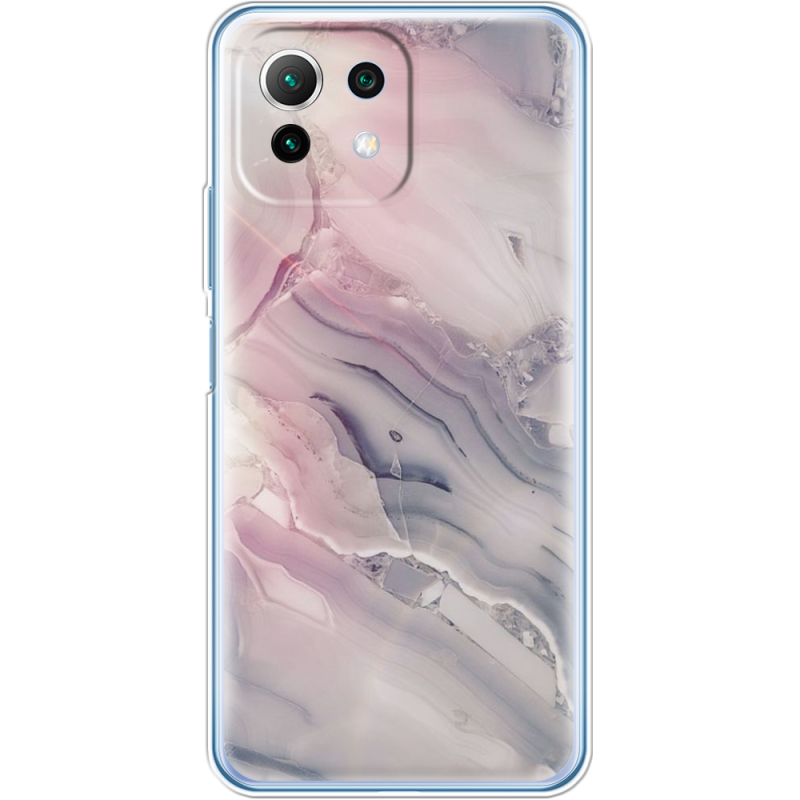 Чехол BoxFace  Xiaomi 11 Lite 5G NE 
