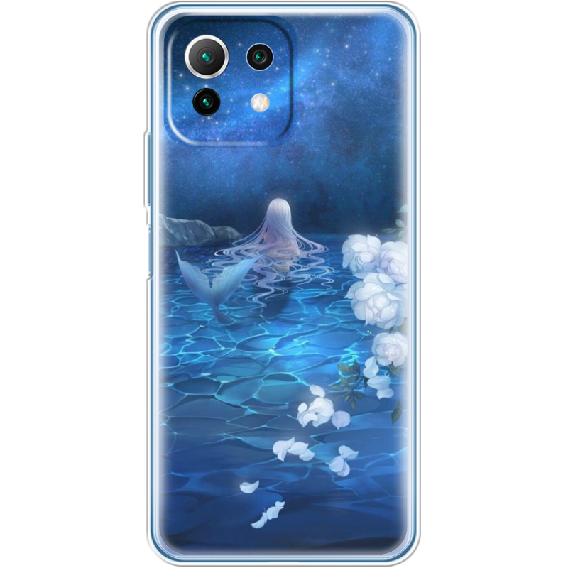 Чехол BoxFace  Xiaomi 11 Lite 5G NE 