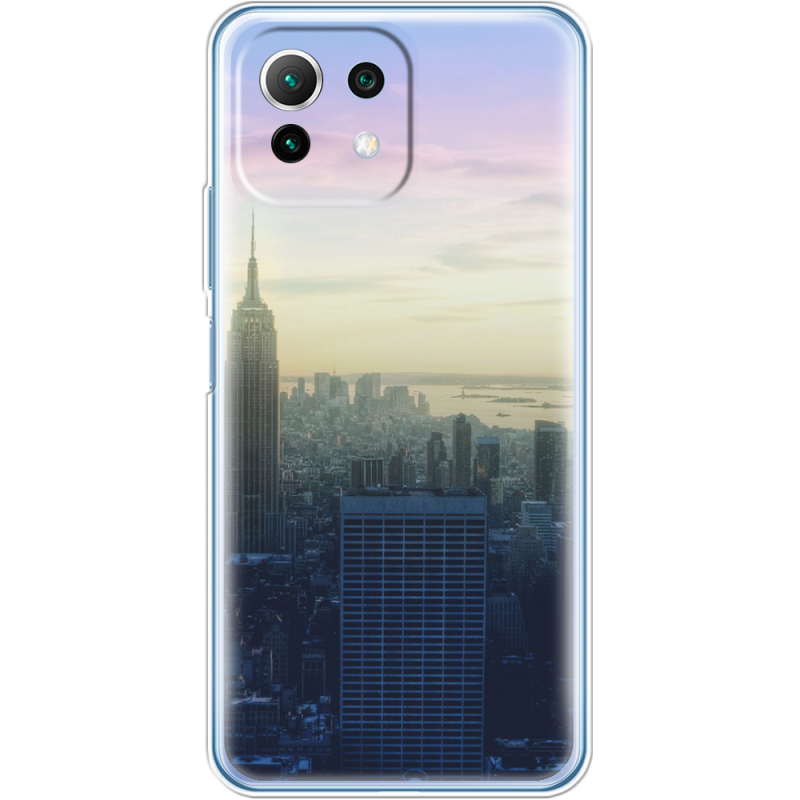 Чехол BoxFace  Xiaomi 11 Lite 5G NE 