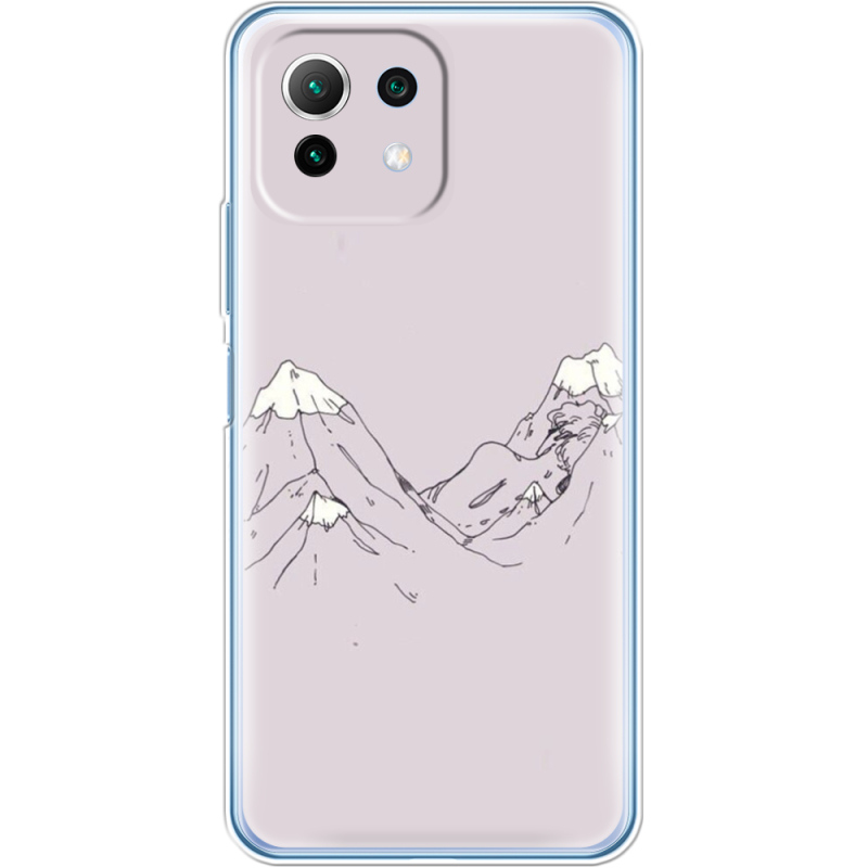 Чехол BoxFace  Xiaomi 11 Lite 5G NE 