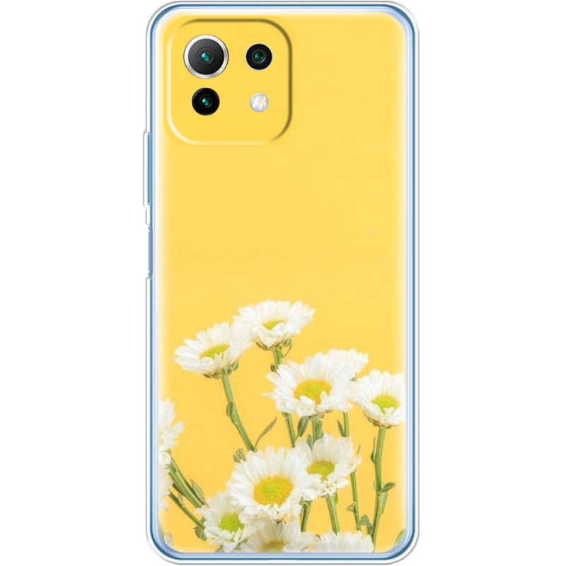 Чехол BoxFace  Xiaomi 11 Lite 5G NE 