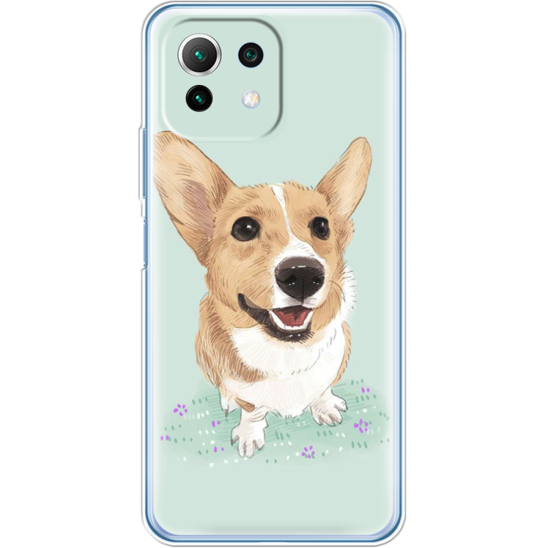 Чехол BoxFace  Xiaomi 11 Lite 5G NE 