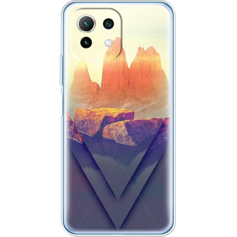 Чехол BoxFace  Xiaomi 11 Lite 5G NE 