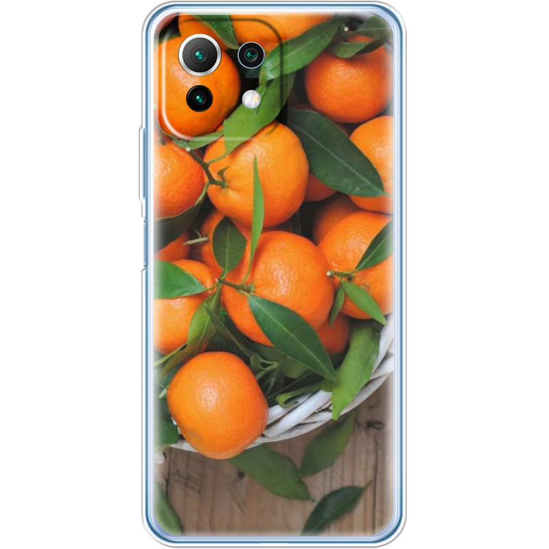 Чехол BoxFace  Xiaomi 11 Lite 5G NE 