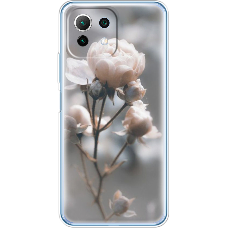 Чехол BoxFace  Xiaomi 11 Lite 5G NE 
