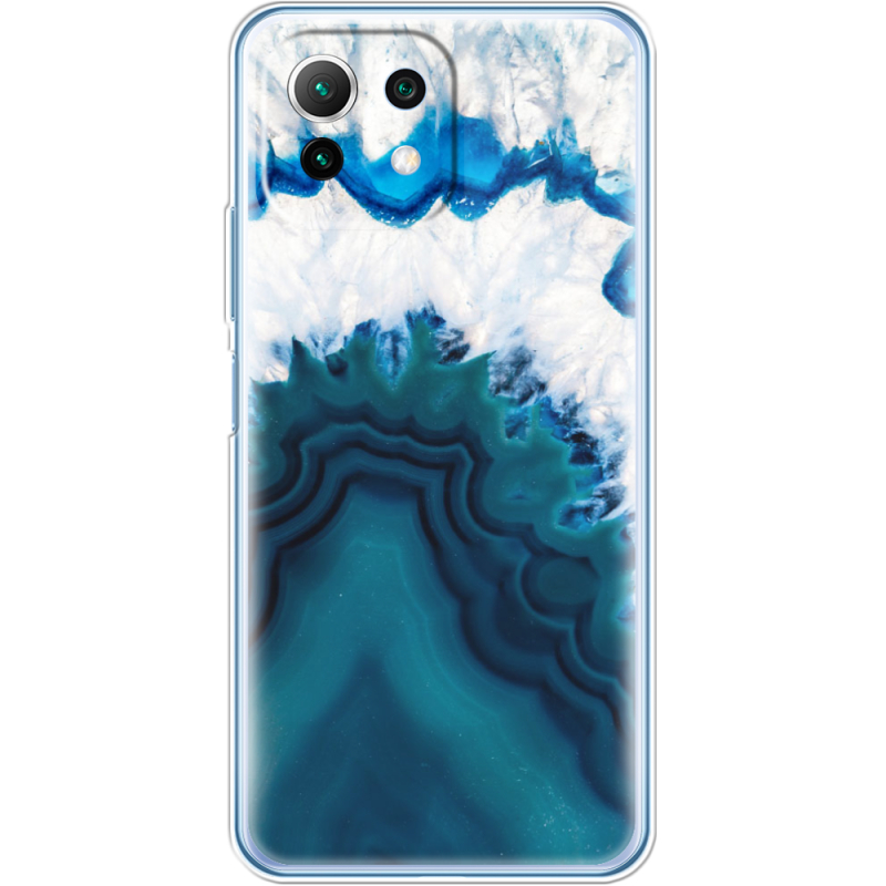 Чехол BoxFace  Xiaomi 11 Lite 5G NE 