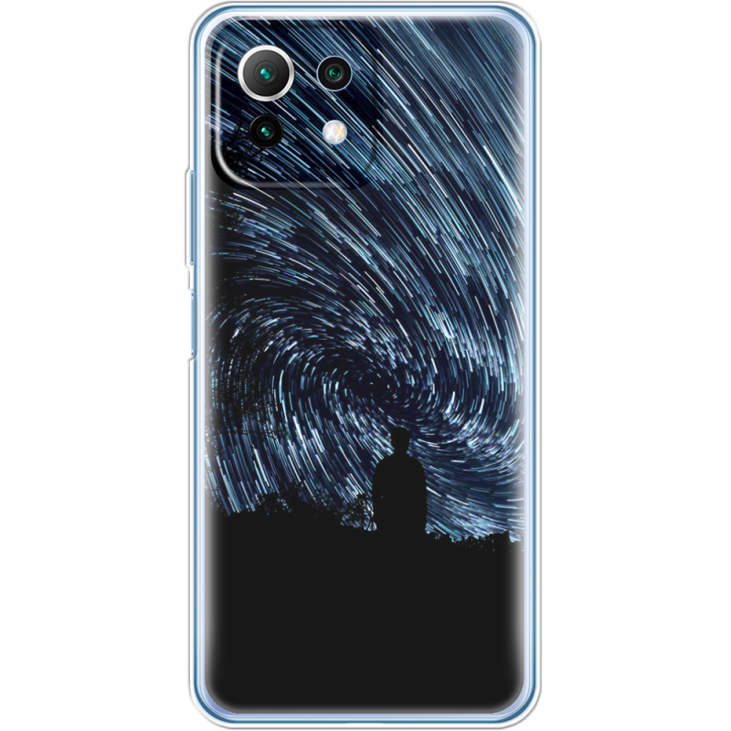 Чехол BoxFace  Xiaomi 11 Lite 5G NE 
