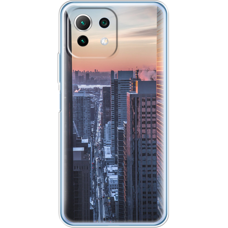 Чехол BoxFace  Xiaomi 11 Lite 5G NE 