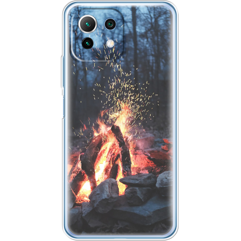 Чехол BoxFace  Xiaomi 11 Lite 5G NE 
