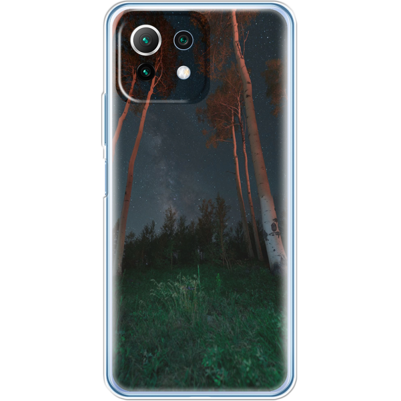 Чехол BoxFace  Xiaomi 11 Lite 5G NE 