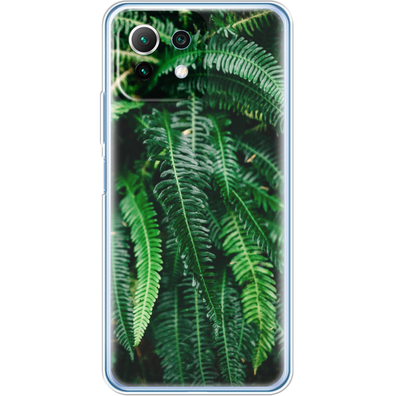 Чехол BoxFace  Xiaomi 11 Lite 5G NE 