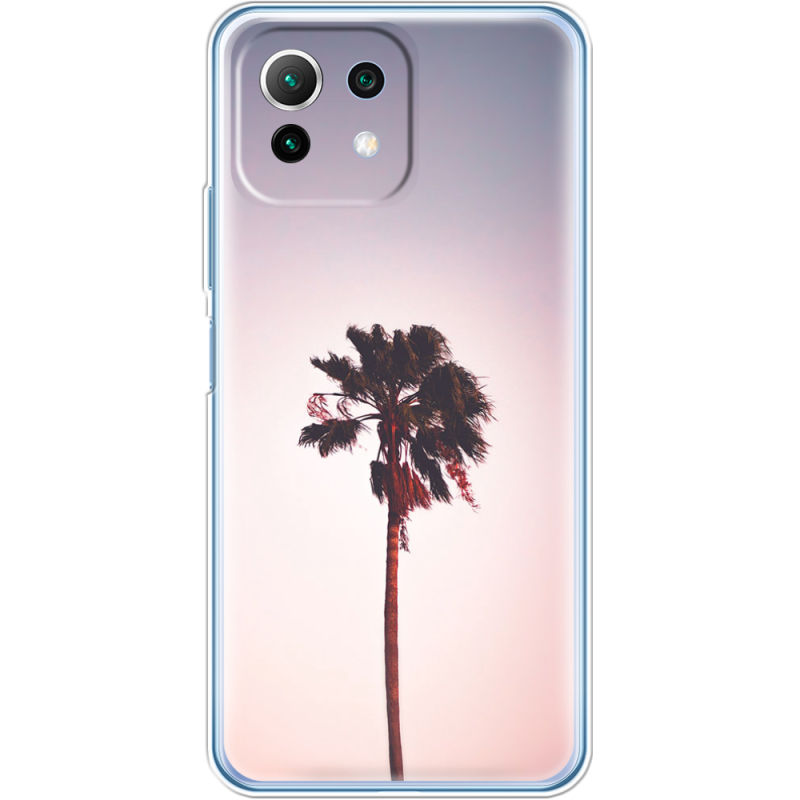 Чехол BoxFace  Xiaomi 11 Lite 5G NE 