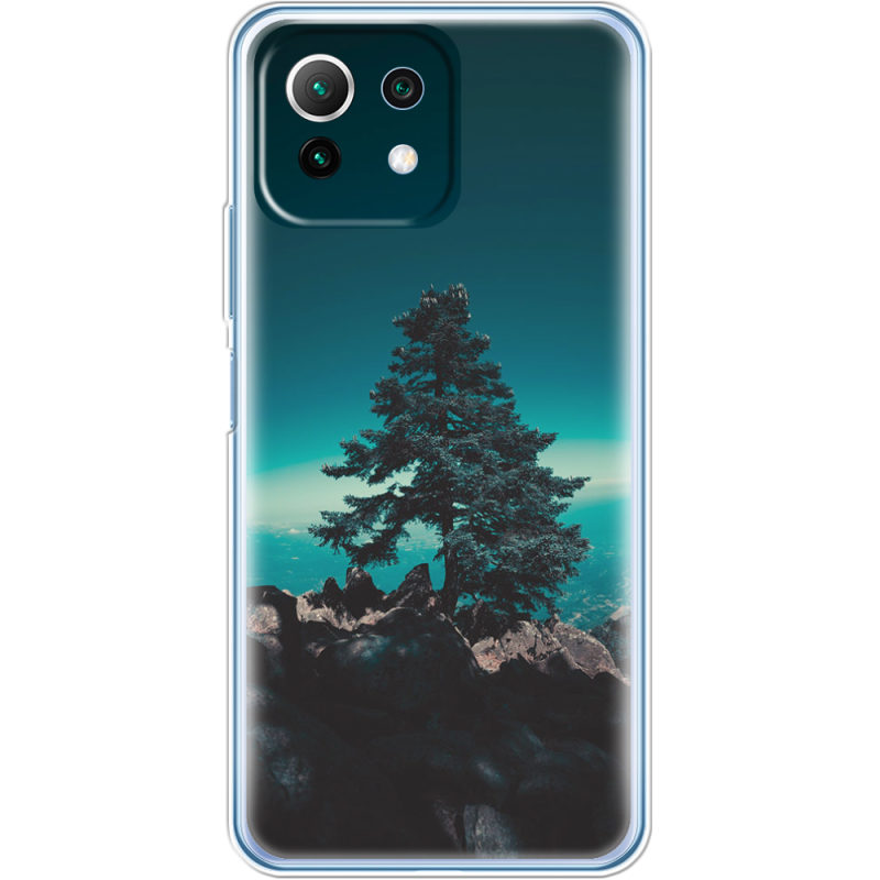 Чехол BoxFace  Xiaomi 11 Lite 5G NE 