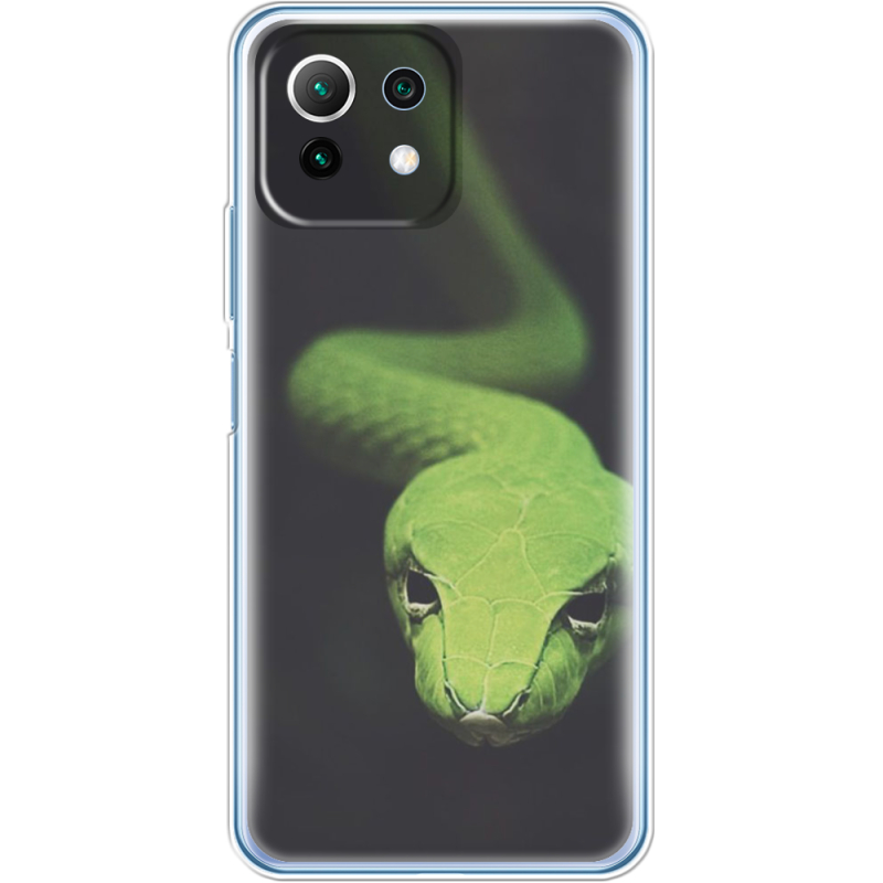 Чехол BoxFace  Xiaomi 11 Lite 5G NE 