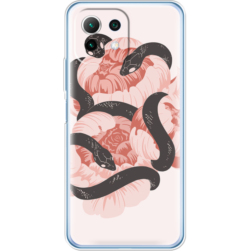 Чехол BoxFace  Xiaomi 11 Lite 5G NE 