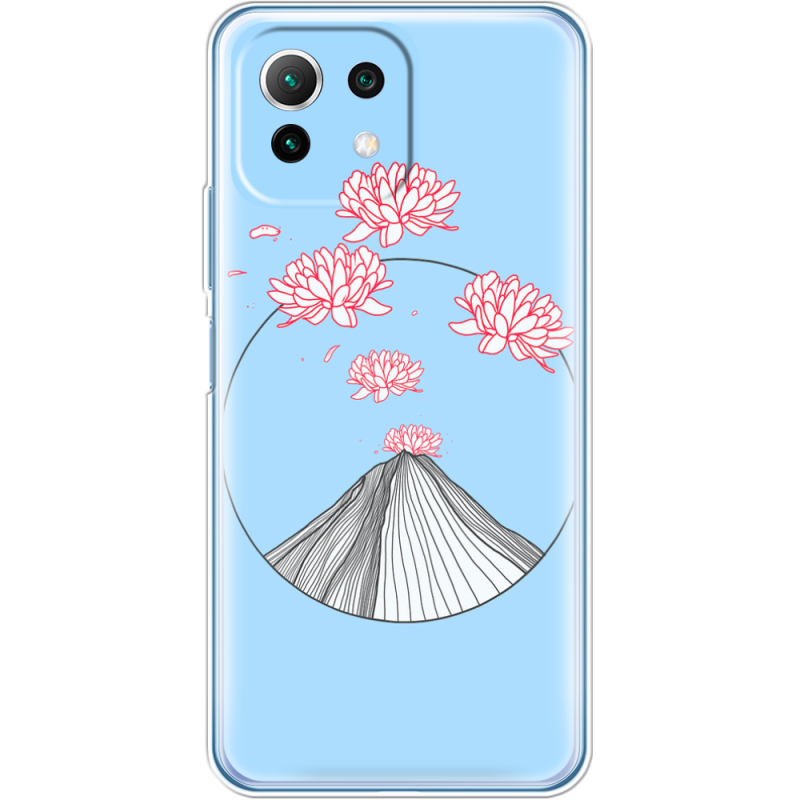 Чехол BoxFace  Xiaomi 11 Lite 5G NE 