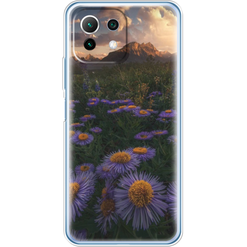 Чехол BoxFace  Xiaomi 11 Lite 5G NE 