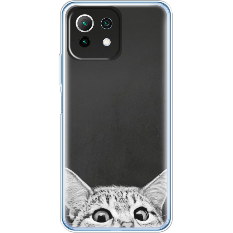 Чехол BoxFace  Xiaomi 11 Lite 5G NE 