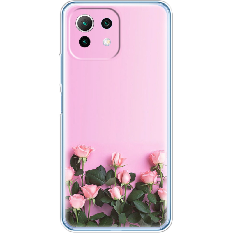 Чехол BoxFace  Xiaomi 11 Lite 5G NE 