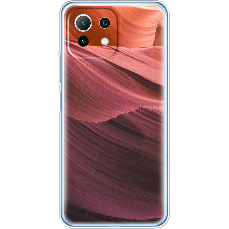 Чехол BoxFace  Xiaomi 11 Lite 5G NE 