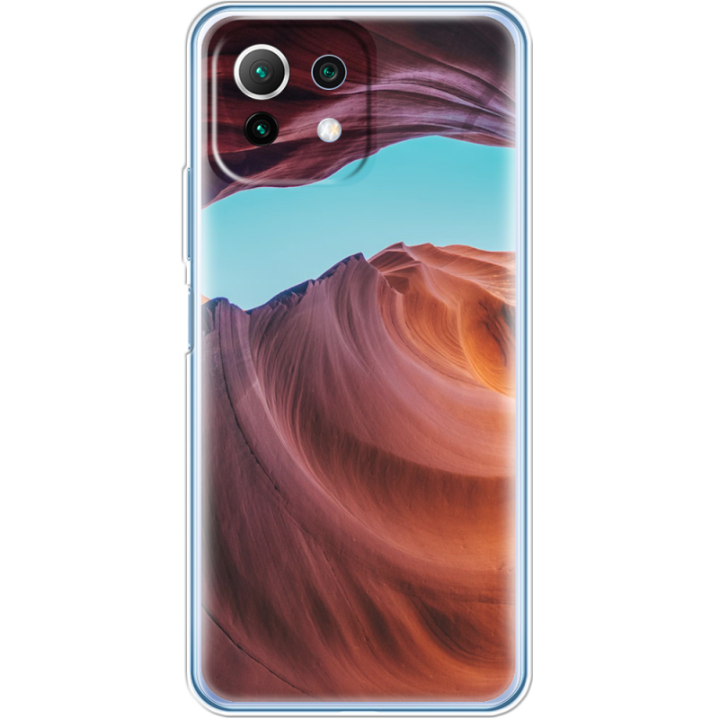 Чехол BoxFace  Xiaomi 11 Lite 5G NE 