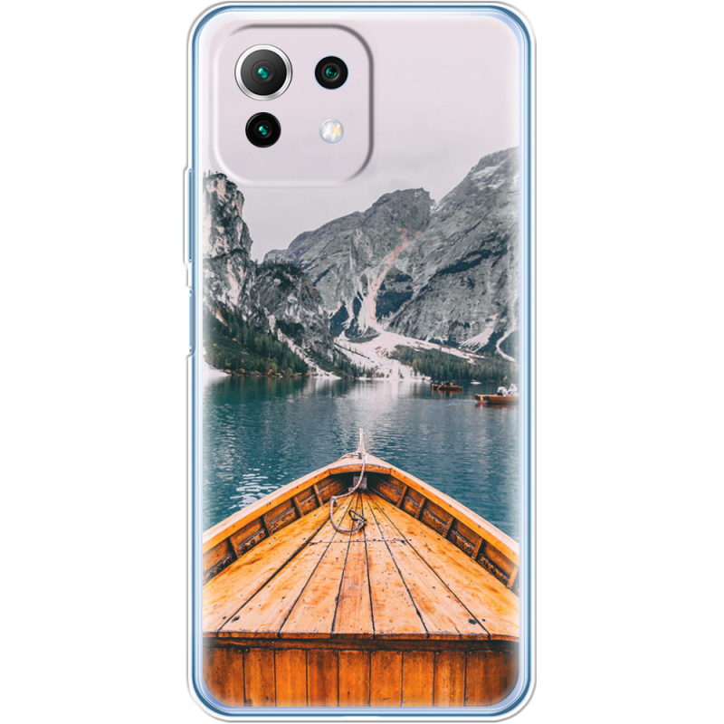 Чехол BoxFace  Xiaomi 11 Lite 5G NE 
