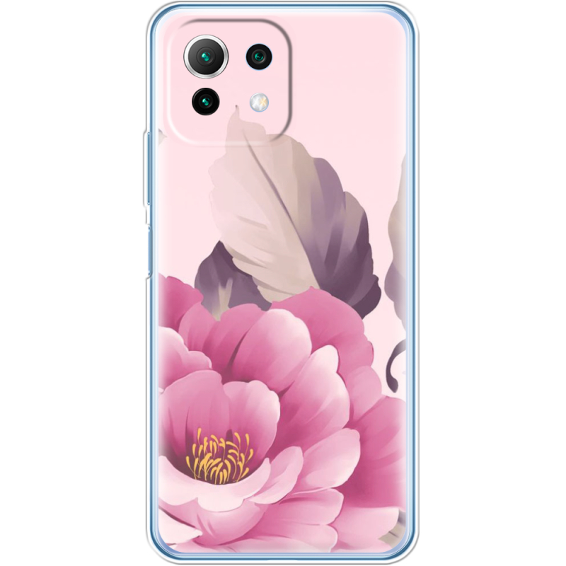 Чехол BoxFace  Xiaomi 11 Lite 5G NE 