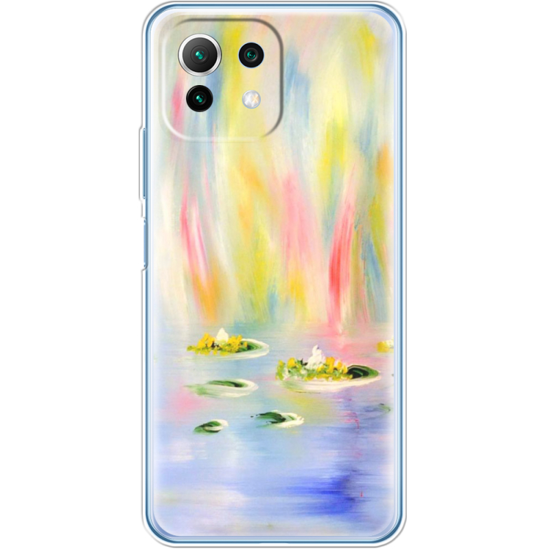 Чехол BoxFace  Xiaomi 11 Lite 5G NE 