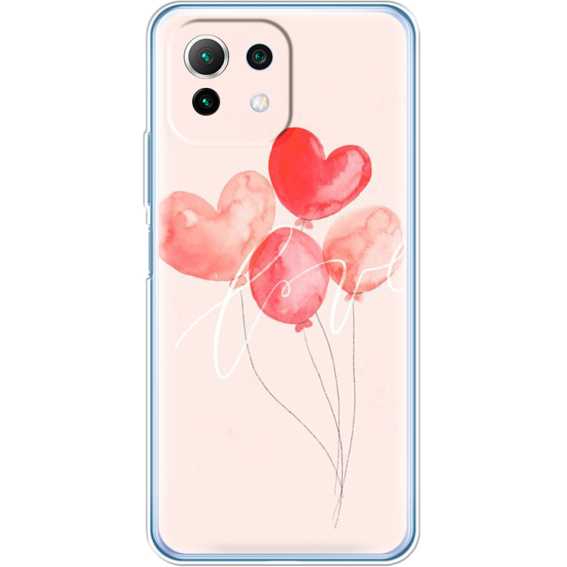 Чехол BoxFace  Xiaomi 11 Lite 5G NE 