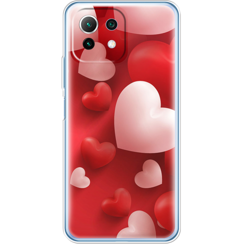 Чехол BoxFace  Xiaomi 11 Lite 5G NE 