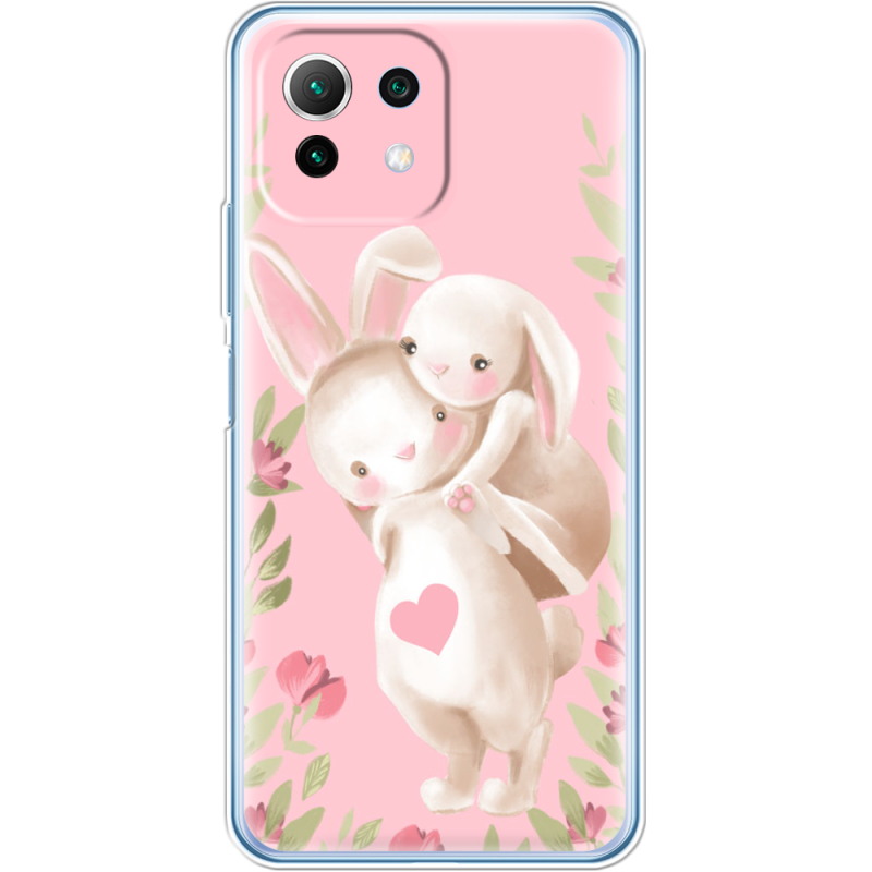 Чехол BoxFace  Xiaomi 11 Lite 5G NE 
