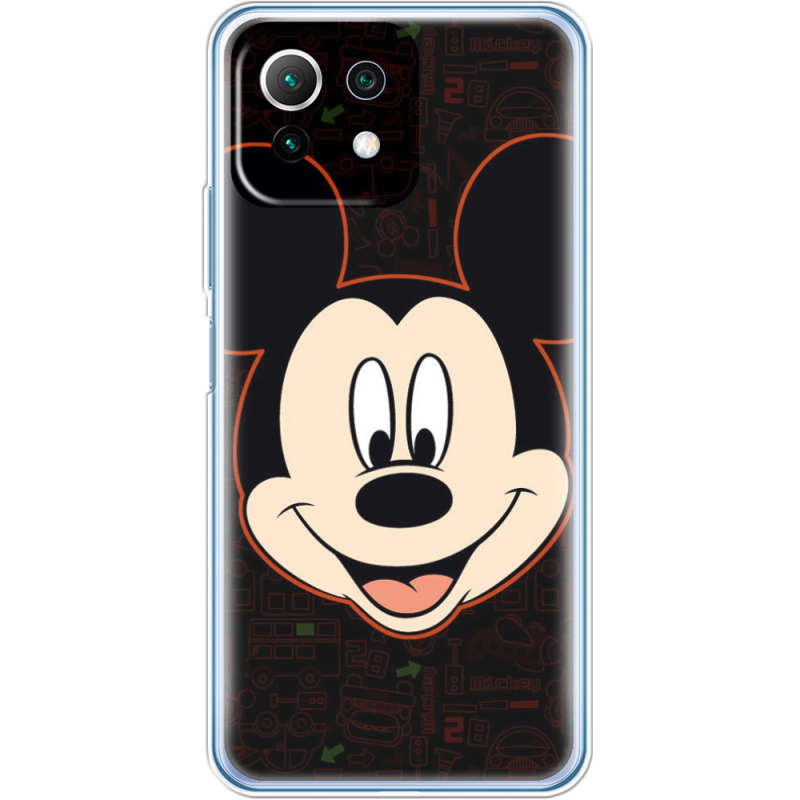 Чехол BoxFace  Xiaomi 11 Lite 5G NE 