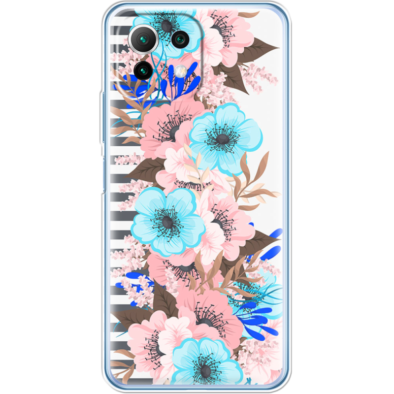 Чехол BoxFace  Xiaomi 11 Lite 5G NE 